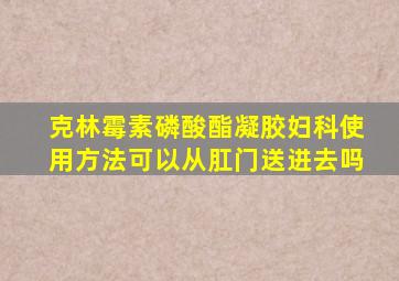 克林霉素磷酸酯凝胶妇科使用方法可以从肛门送进去吗